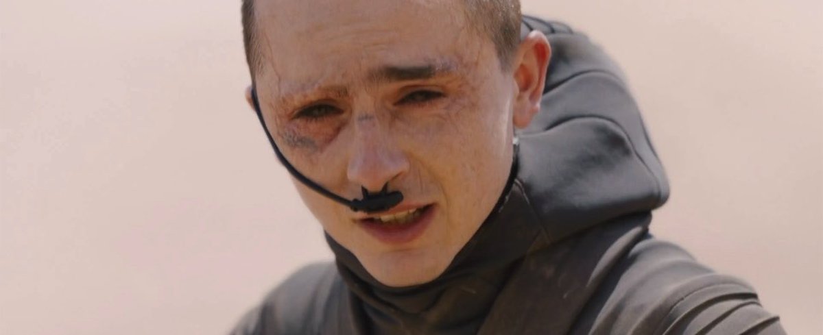 carnorings's tweet photo. id be crying if i looked like that too bruh that's fucked up what they be doing to yall https://t.co/YkwbFug3yZ