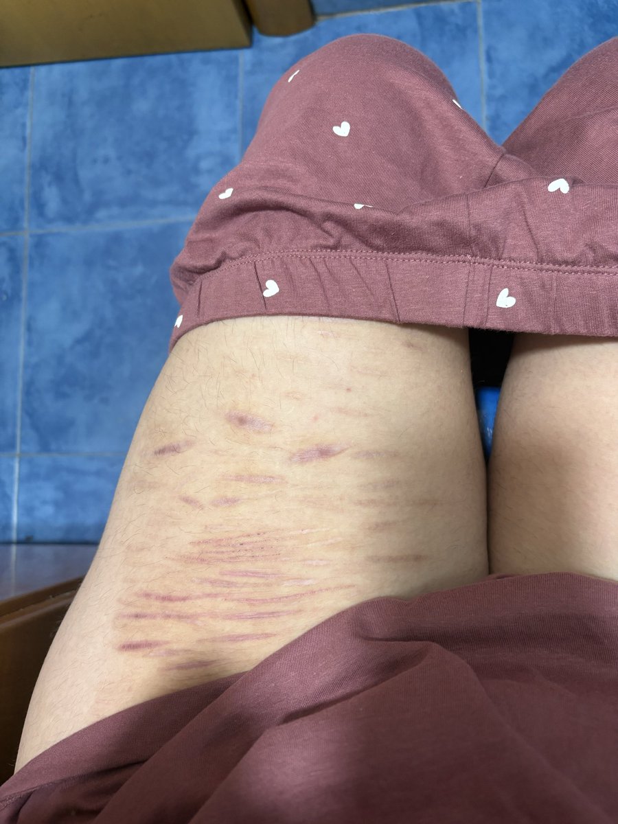 pierceedup's tweet photo. las odio pero a la vez me gustaría tener más https://t.co/71ZgAircTb