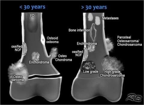 guidelinesMed's tweet photo. Bone lesions https://t.co/TLTWhu0CKS