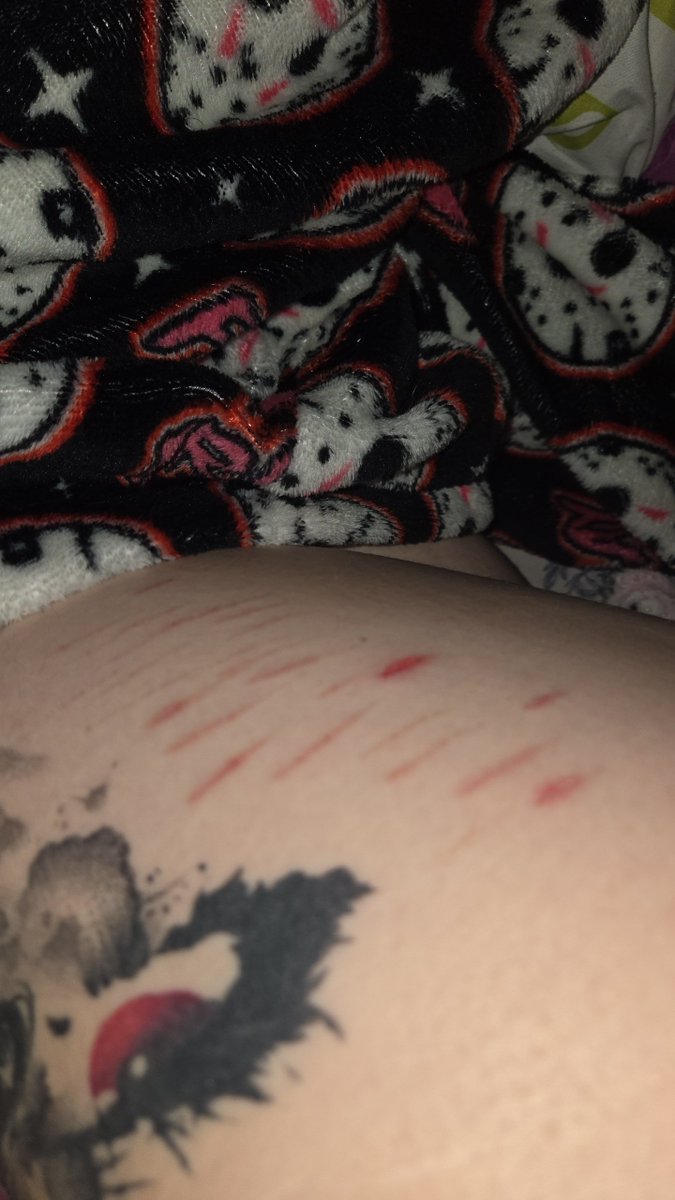 st4rvedghost's tweet photo. I love how pretty my scars are.
Big one isn't quite a scar yet, reached beans the last time lol
ITS ALL FAKE SFX FAKE #sfxshtwt #shtwt https://t.co/EjYhSghuBE