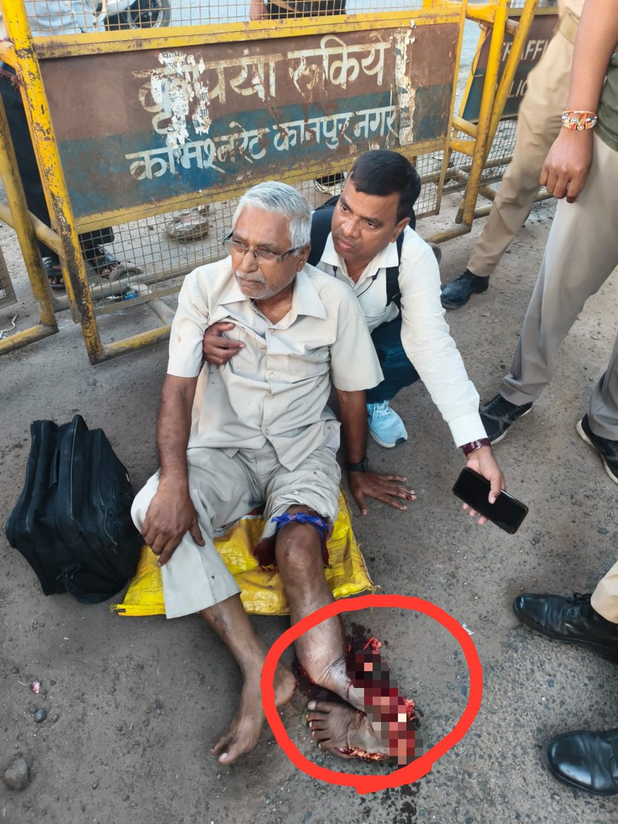 kanpursneed's tweet photo. कल्याणपुर में मौरंग लदे डंपर ने साइकिल सवार बुजुर्ग को चढ़ा पैर बुरी तरह क्षतिग्रस्त

इसका ज़िम्मेदार सिर्फ प्रणव सिंह है जिन्होने कल्याणपुर कट खुलवाया, अंकल जी का पैर किसी सनकी की राजनीति की भेंट चढ़ गया...

भले ही वो आगे आकर कहेंगे की मेरे हॉस्पिटल मे इलाज़ करा लो पर उससे पैर नहीं जुड़ जायेगा।

#kanpur 
@DMKanpur @CMOfficeUP @myogiadityanath
