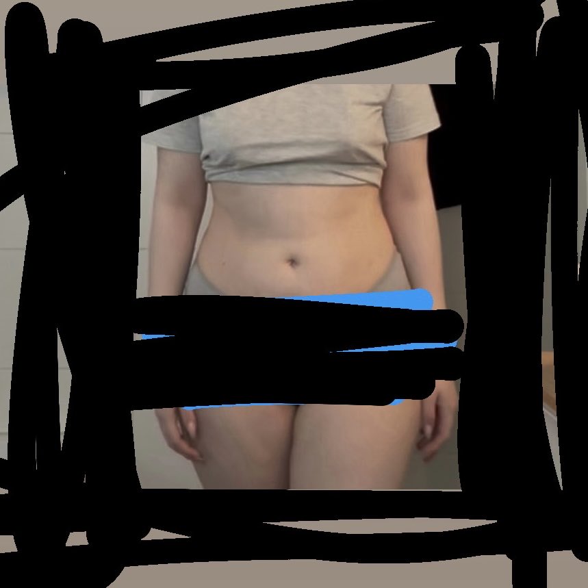 chardiaryy's tweet photo. Do yall see a difference or am I insane for thinking I look the same?? 

#edtwt #weightloss https://t.co/FYwC4nnuFK