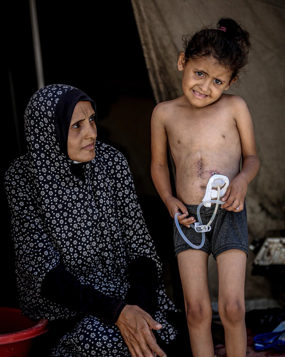 HelpRebuidGaza's tweet photo. Urgent Appeal 🚨 A child named Samira needs an urgent surgery costing $700. I appeal to every compassionate heart to help and donate to save her and her sibling’s life. 🙏😞

https://t.co/SDqcBJDm9K

you can donate to the fundraiser above, may Allah bless you Amen🙏 https://t.co/uiERhc06sl