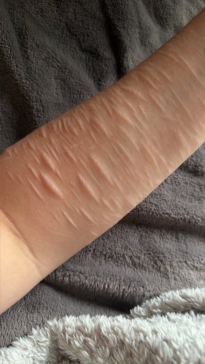worldafterme's tweet photo. Cutting or starving? https://t.co/9uFPqA4sVZ