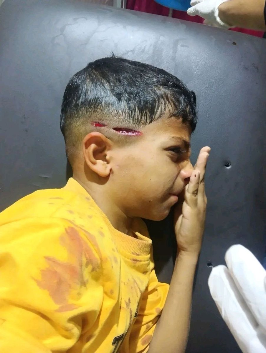 josepgoded's tweet photo. Israeli snipers shot Palestinian child Imad Salem Zahra in the head east of Al-Bureij camp, central Gaza. https://t.co/F2mRhHI0kB