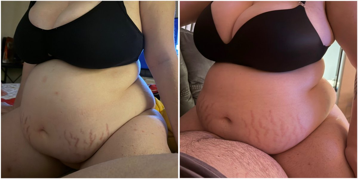 BigMackFeeder's tweet photo. Late March 26-late October 26 
#bbwwomen #bbw #feedee #feedeegirl #weightgain #gettingfatter https://t.co/8zEi6fppAk