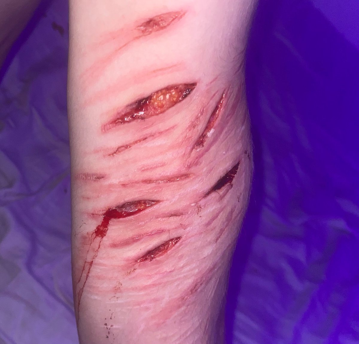 misant0x's tweet photo. Reuploading bcuz why not #shtwt #shedtwt #selfharm #fake #Prop #halloween #fakeblood #blood https://t.co/hpsmds06uU
