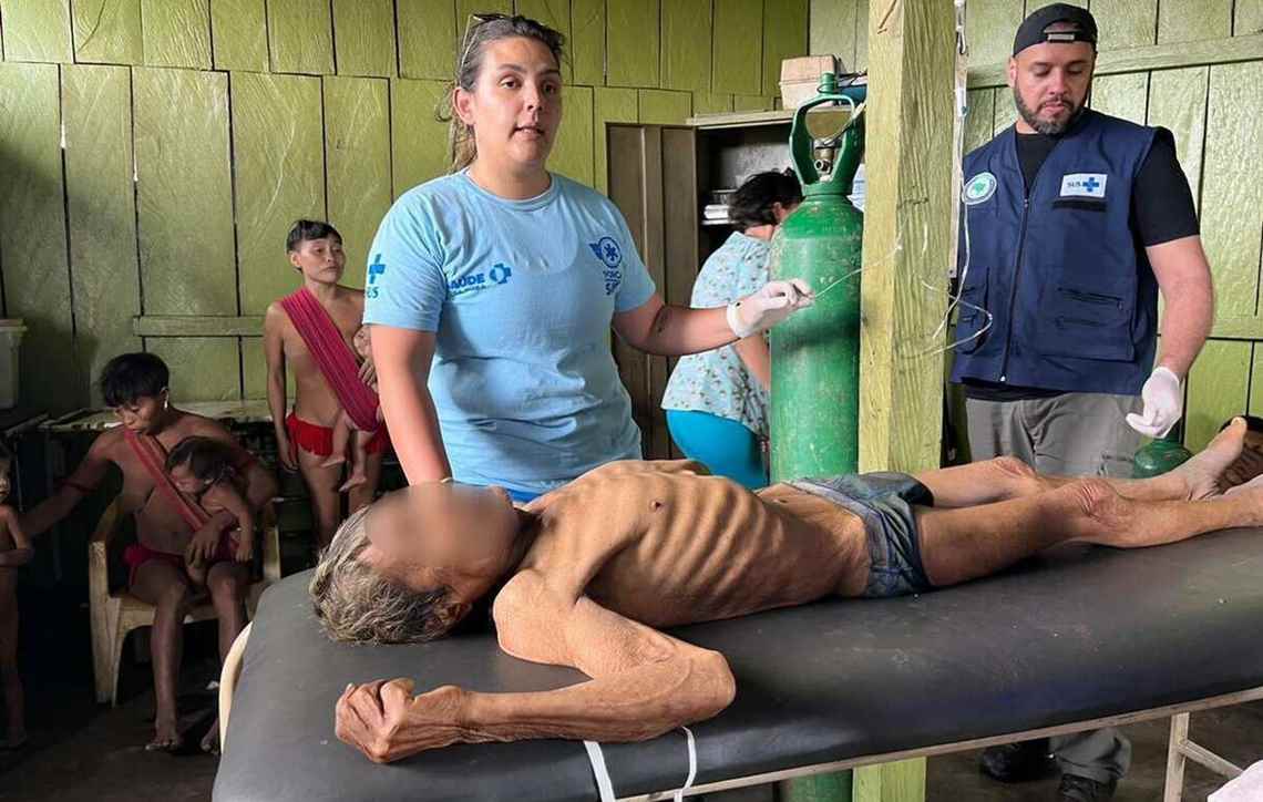 afeastfrcrows's tweet photo. "omg Bolsonaro got zero votes in indigenous areas le heckin frauderino" this is what Lula's government found in Yanomami settlements in january 2023 when he took office after 4 years of Bolsonaro's genocidal policies against indigenous peoples https://t.co/J67fmSizrF