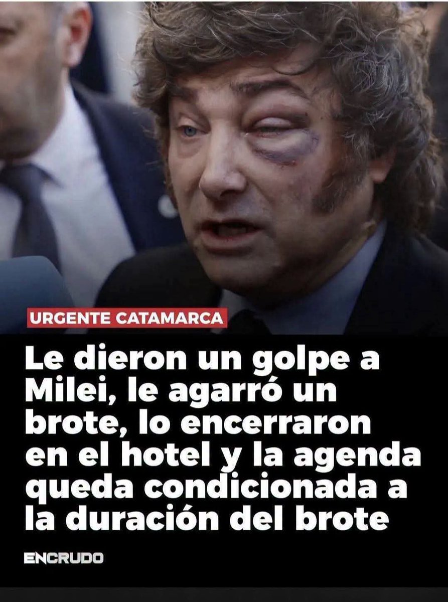 kayntenso7's tweet photo. @iingridrod Lo bueno @iingridrod es que la gente ya se hartó y este coge hermanas que usa pañales ni ninguno que piense como él va a ser reelecto nuevamente. 

Se vienen los mejores 70 años de peronismo que el país jamas vivió. https://t.co/ivFA3tczxj
