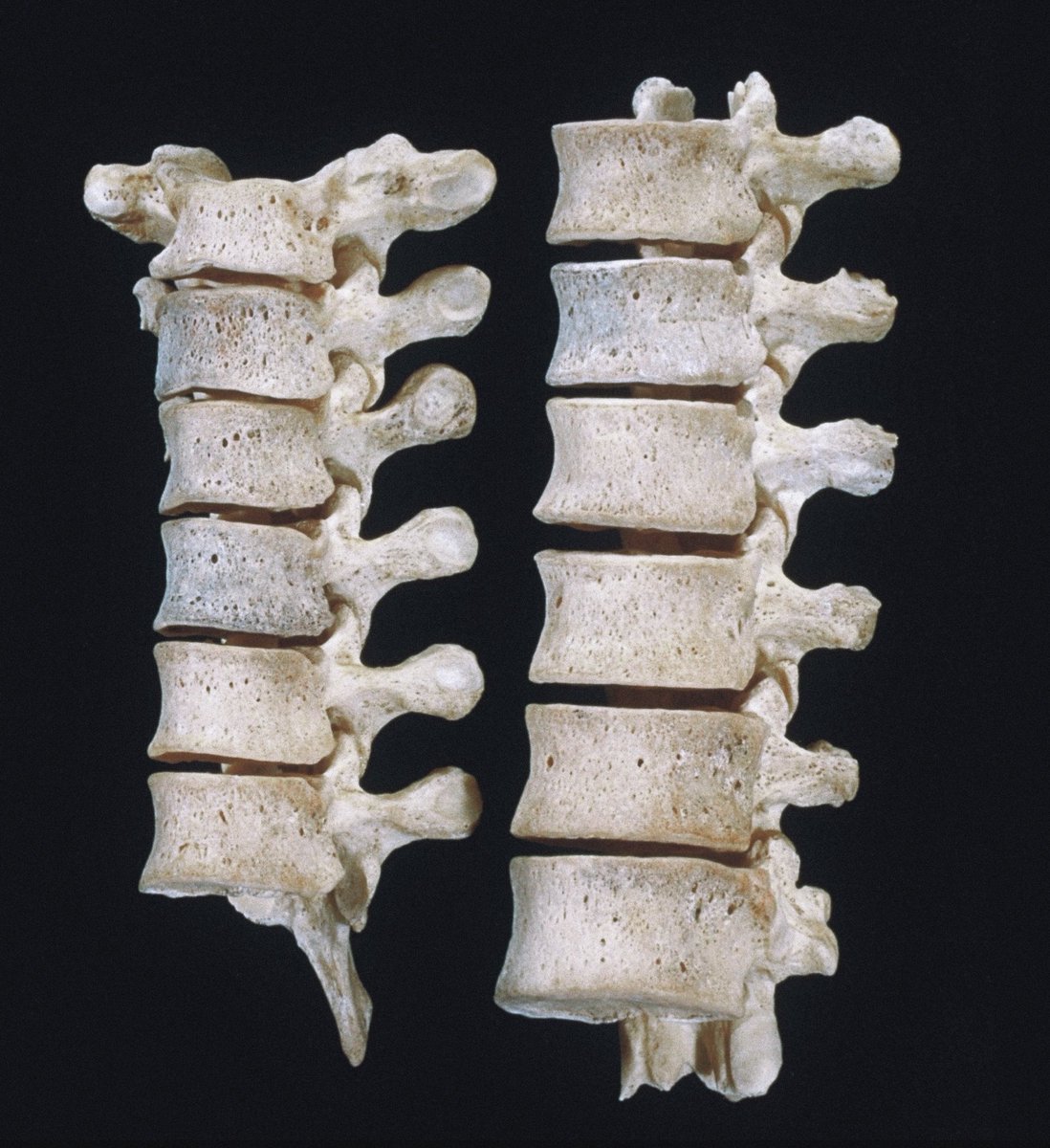 moriitician's tweet photo. vertebrae. ⨾𓍢ִ໋.ೃ࿔:･ https://t.co/8rkarShDZB