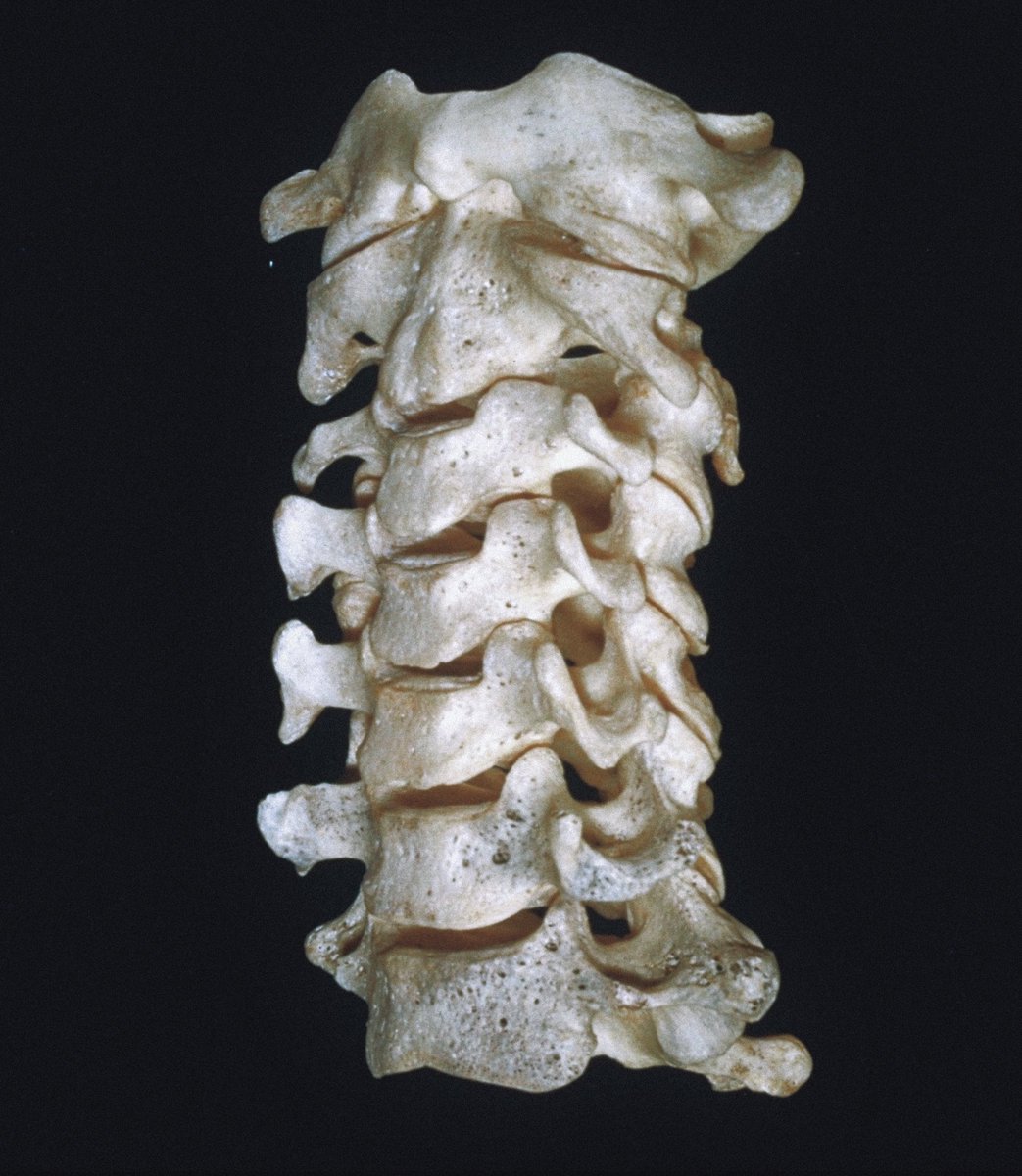 moriitician's tweet photo. vertebrae. ⨾𓍢ִ໋.ೃ࿔:･ https://t.co/8rkarShDZB