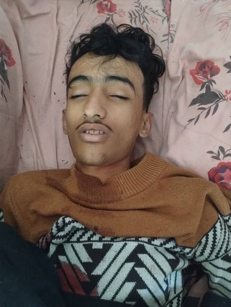 DrAlshameery's tweet photo. احنا مش محتاجين نشوف الجزيرة علشان نعرف جرائم الحوثي.
نحن اليمنيين عشنا وشفنا جرائمه أمامنا 
لا ننتظر من احد ان يرينا جرائمه
ولكن لأنكم لا تصدقون انه مجرم،  كان فيديو الأخ فداء الدين لكم انتم لتعرفوا الحقيقة. 
اما نحن اليمنيين فقد عشنا جرائمه واقعا 
وهذه أمثلة على جرائمه التي لا تحتاج لشاهد