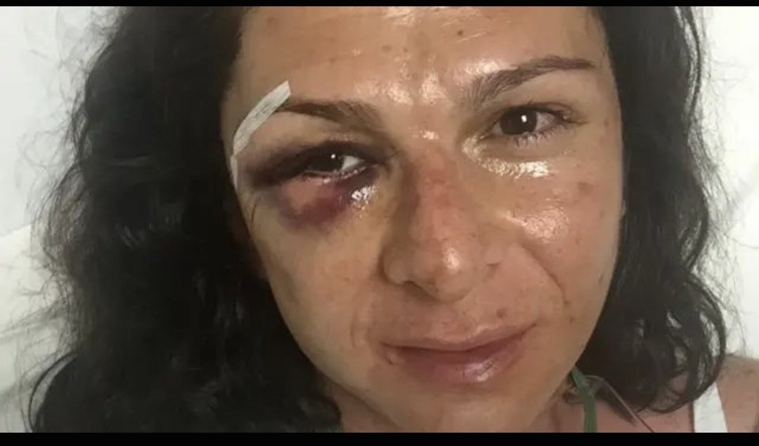 EdithMe1965's tweet photo. @MariaA_PardoJ En serio quiere que le muestre la diferencia entre Vicky Dávila y el misogino maltratador? Por este pequeño detalle señora, como es que dicen ustedes las feministas? Ah sí, sororidad.
👇👇👇👇👇👇👇 https://t.co/KVQOFl844F
