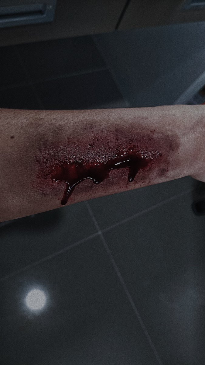 Madcucumber1401's tweet photo. ‼️Fake Blood warning ‼️

เลือดปลอมที่ว่า.....
(ขออภัยสำหรับคนที่กลัวล่วงหน้านะคะ) https://t.co/Y8J35e7fXm