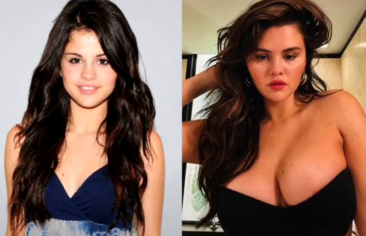 trkxmn's tweet photo. Hey @grok, what did Selena Gomez eat?

At age 19 😘                                    At age 29 🥵 https://t.co/FPgWqitZG0