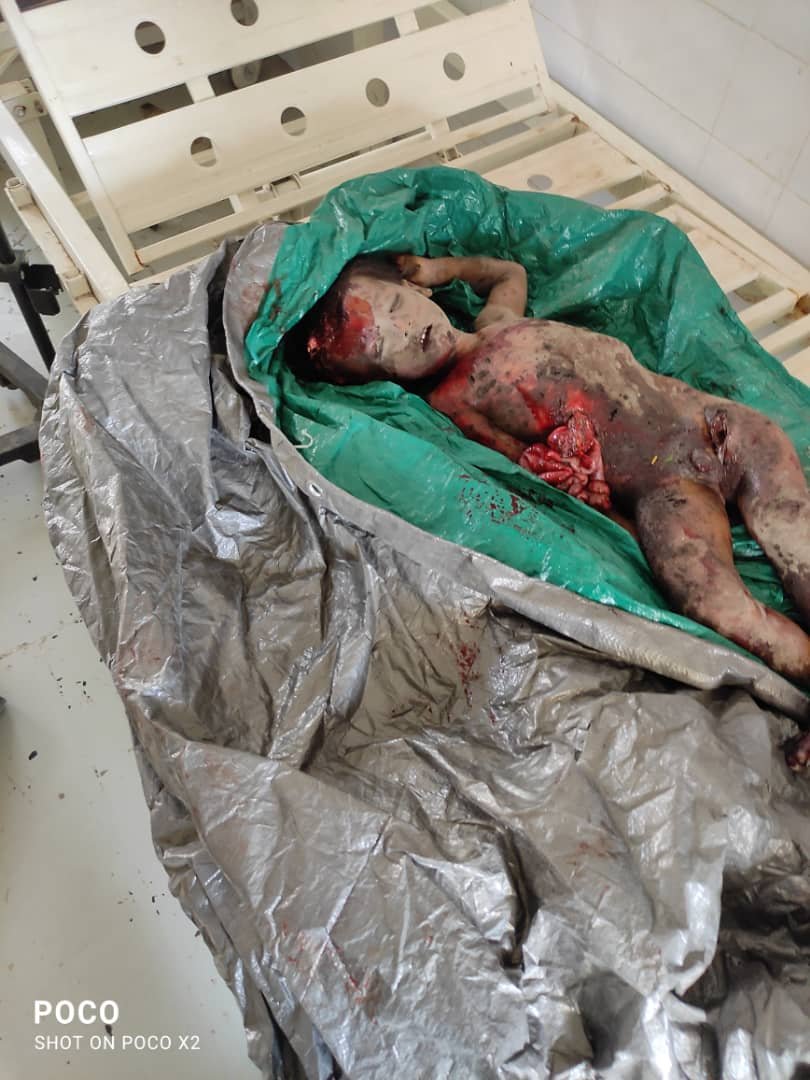 alasbahi_dr's tweet photo. 12 شهيدا و3 جرحى معظمهم نساء وأطفال
مشاهد من المجزرةبحق المواطنين  استشهدو إثر غارات جوية شنها طيران العدوان السعودي على منطقة الحبيبه عزلة البرح مديرية مقبنة محافظة تعز ظهر الخميس 29 اكتوبر 2026م مستهدفًا منازل
 أسرتي  إبراهيم سعيد محمد أحمد القوز  والراعبي سعيد محمد أحمد القوز https://t.co/usS8SgCqDp