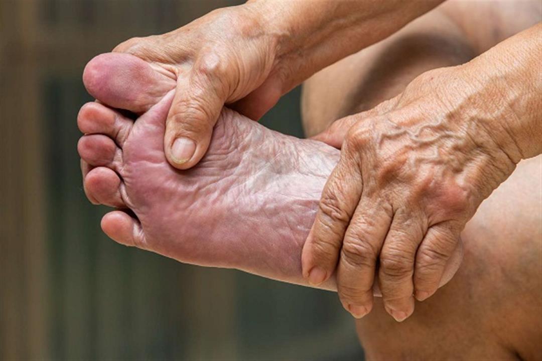 أعراض السكري في القدمين- 7 علامات لا تتجاهلها 