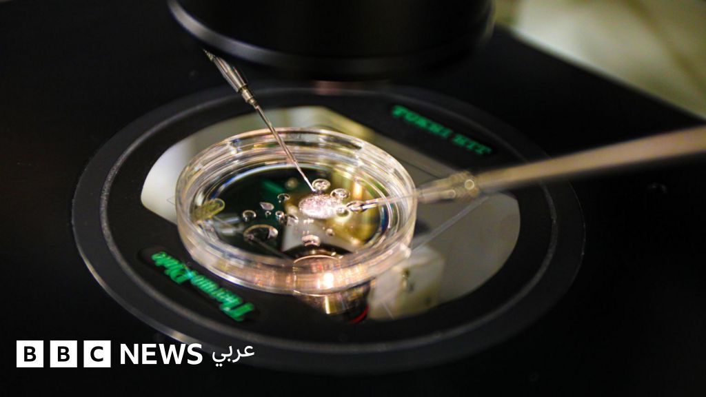 نجح علماء أمريكيون، للمرة الأولى، في إنتاج أجنة بشرية في مراحلها المبكرة من خلال التلاعب بالحمض النووي المأخوذ من خلايا الجلد ثم تخصيبه بالحيوانات المنوية 