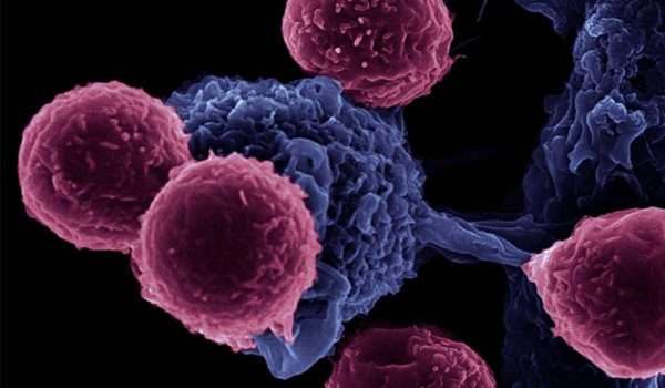 ما المقصود بـ أمراض المناعة الذاتية؟ تعرفوا من التالي على الأسباب التي تجعل الجسم يهاجم نفسه، والأعراض المختلفة، وطرق التشخيص والعلاج المتاحة. 