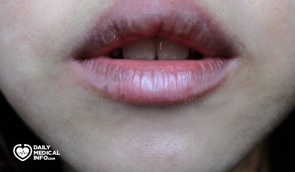 أسباب سواد الشفايف وكيفية علاجه، تعرفوا من التالي على العوامل المسببة لتصبغ الشفاه وطرق استعادة لونها الطبيعي. 