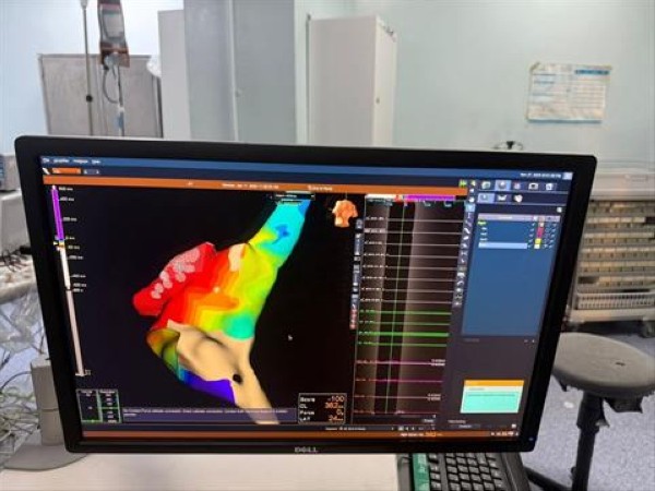 إجراء أول عمليات كي لتسارع دقات القلب غير المنتظم بمستشفى الملك المؤسس #الاردن 