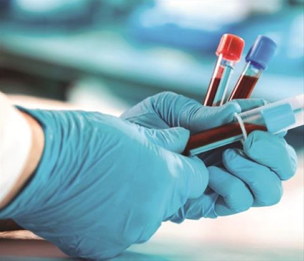 "الصحة": فحوصات عاملات المنازل ضرورة #الاردن 