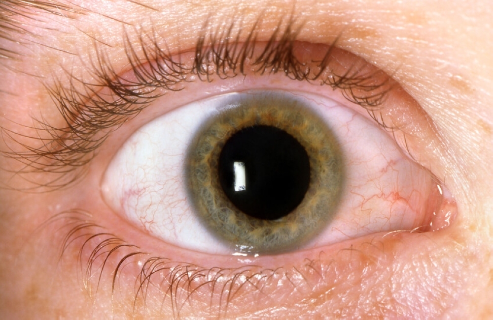 السكري وتأثيره الخفي على #البصر 