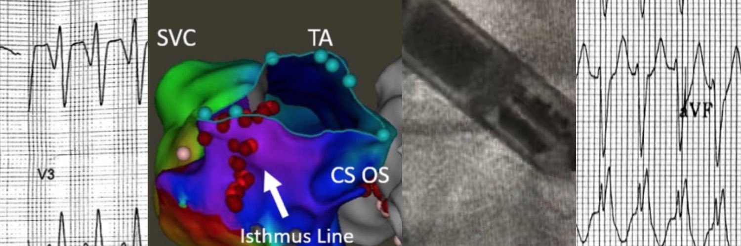 Shashank Jain, MD FACC banner