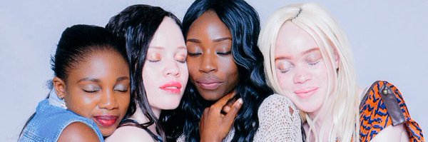 MissAlbinismzim Profile Banner