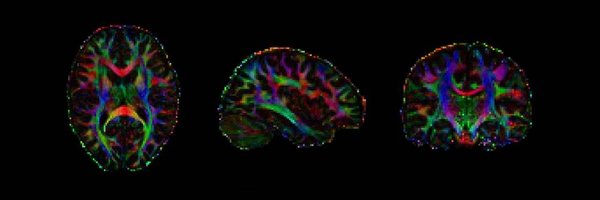 NeuroRae Profile Banner