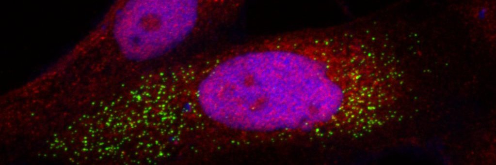 Adi Sandbichler banner