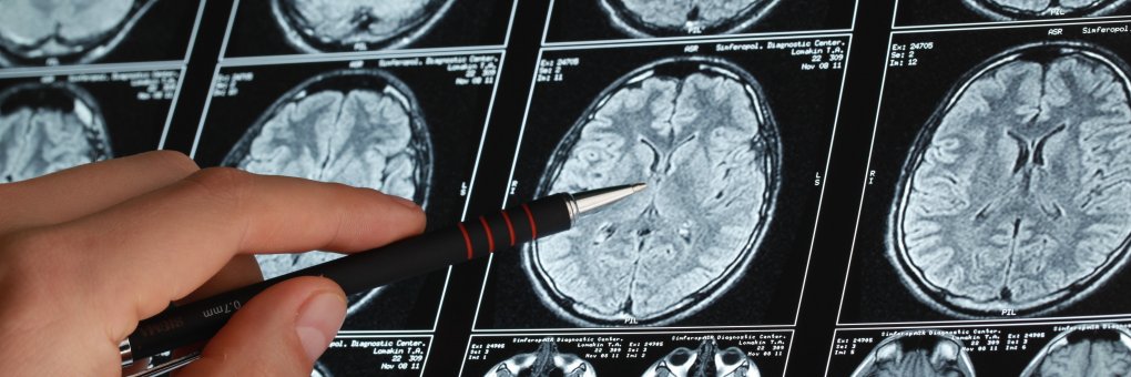 Neuroscience at Assumption University banner