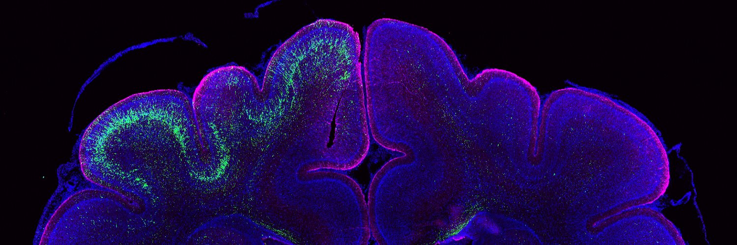 Nereo Kalebic banner