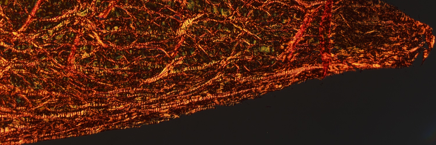 Andreas Martin Seitz (JointBiomech Group @ UFBUlm) banner