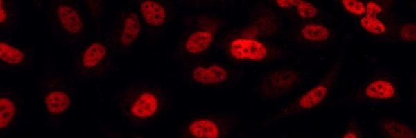 HypoxiP Profile Banner