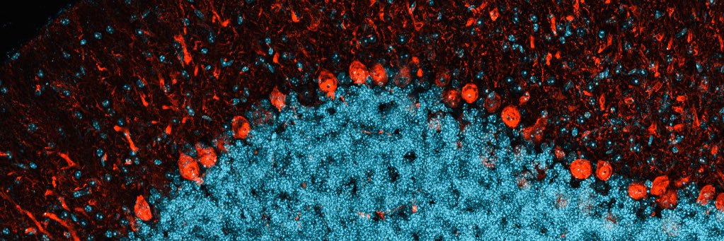 Carin Papendorp, MD, PhD banner