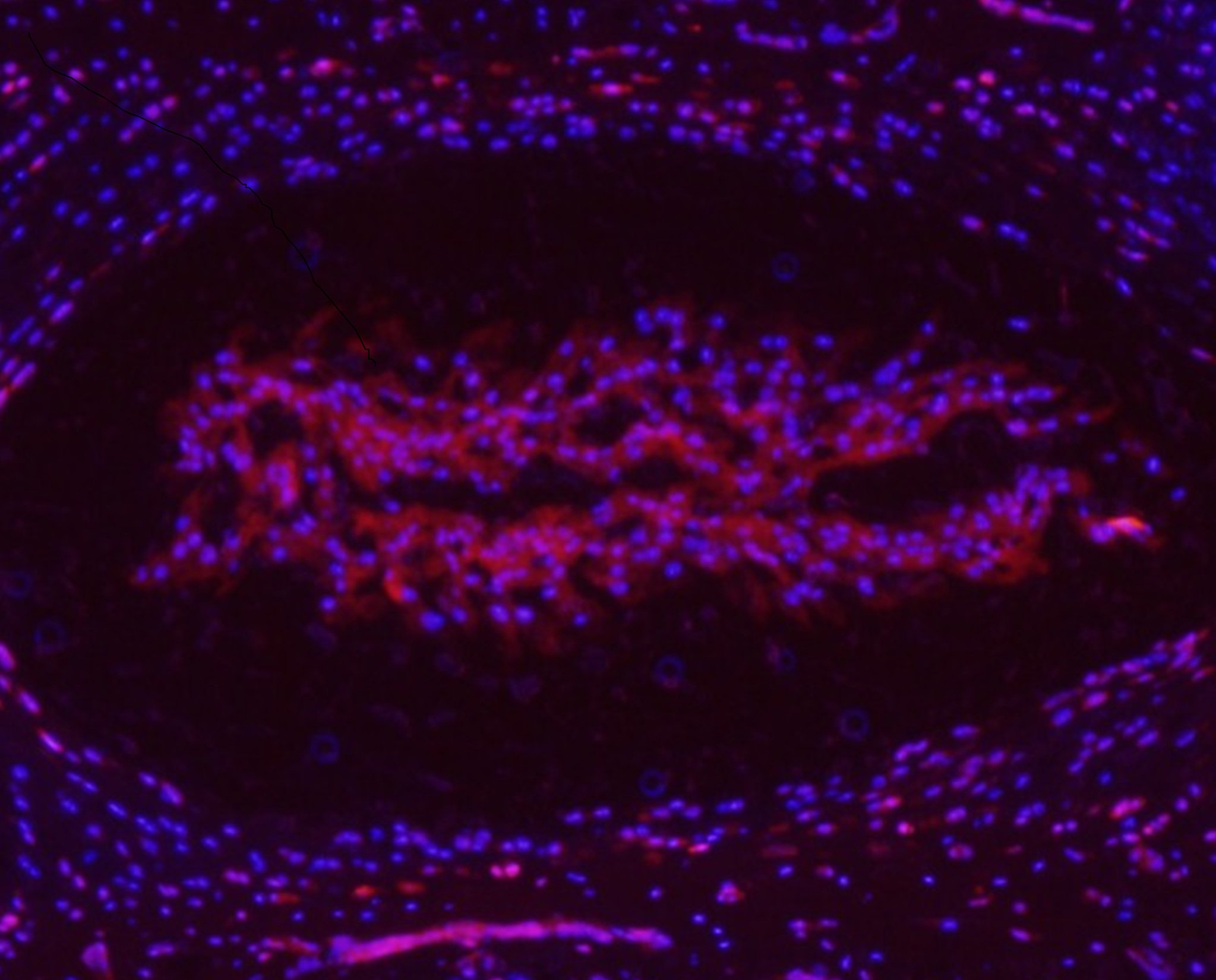 Nilsson Holguin banner