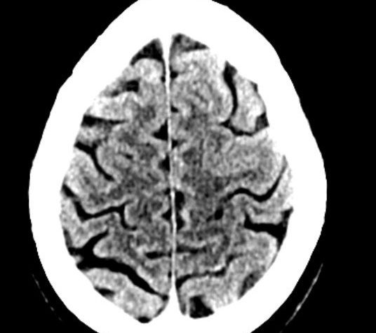 Fausto Caruana banner