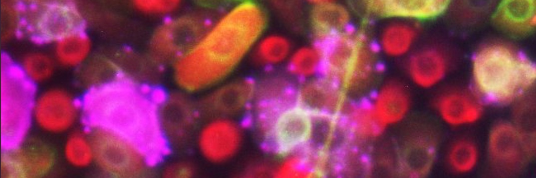 Sandeep Singh banner