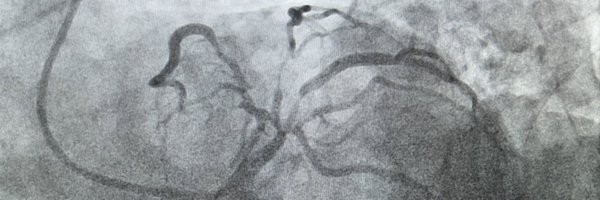 OpolskiMP Profile Banner