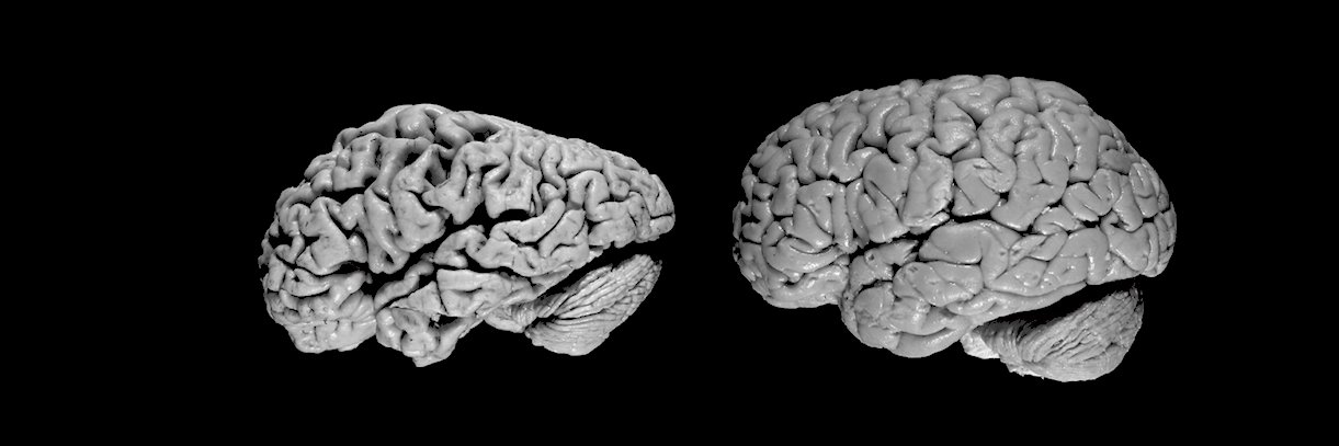 Center for Precision Neuroimaging banner