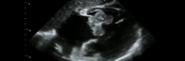 syedmalimd Profile Banner