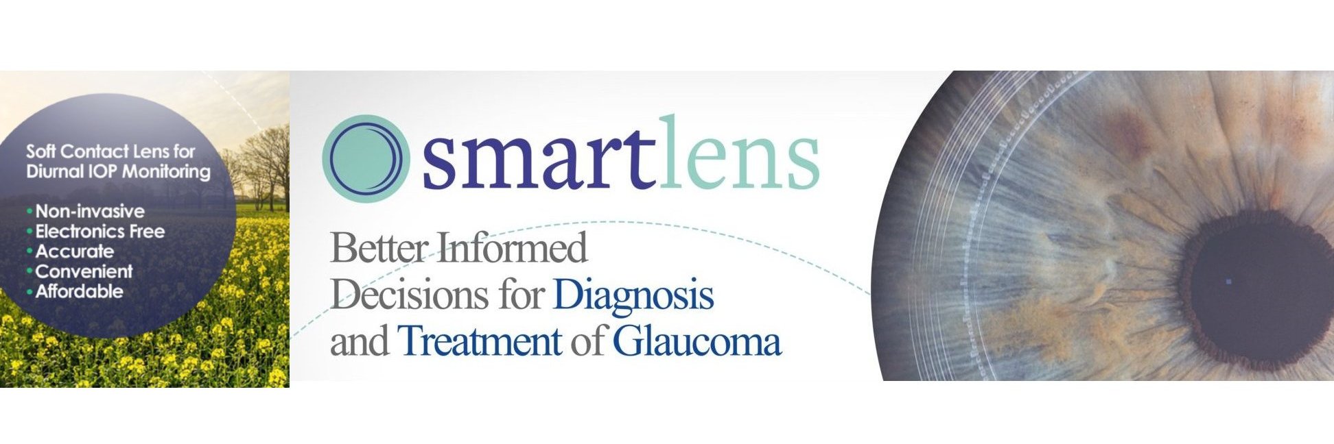 Smartlens banner