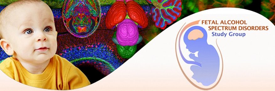 FASD Study Group banner