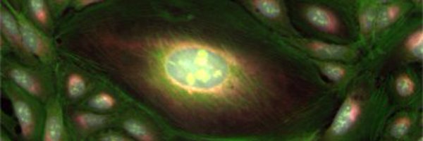 EsbenSv Profile Banner