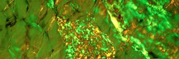 MayoAmyloid Profile Banner
