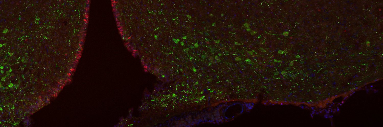 Fernando Cázarez banner