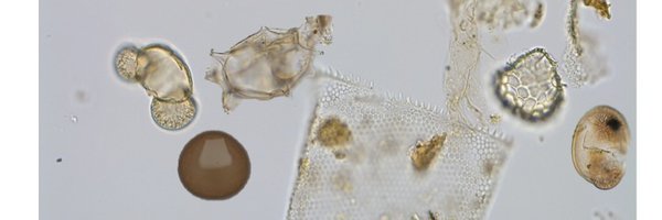 CanadianAcp Profile Banner