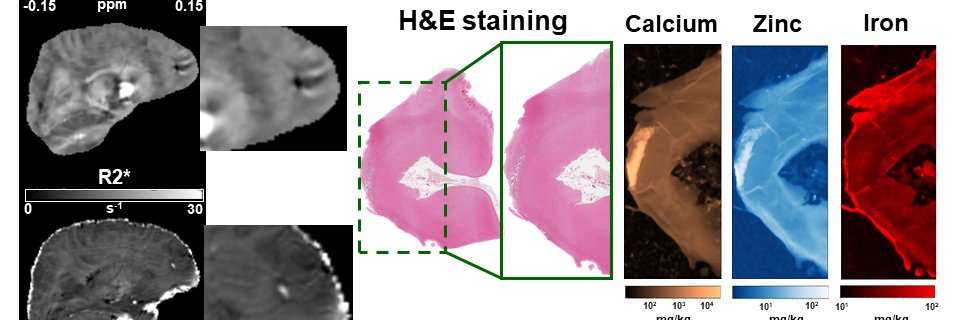 DavidCarmichael_Neuroimaging banner
