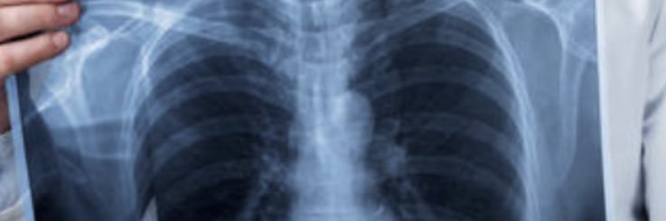 p.antune@hotmail.com banner